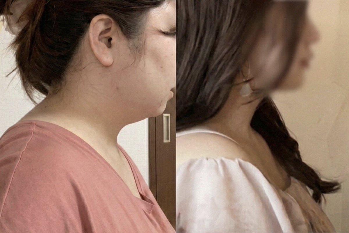 はなゆん@94kgからの大幅減量 (@hanayun_16294) / Posts / X