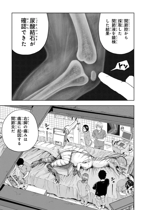 恐竜のお医者さんが「痛風」を治療する話(5/8) 