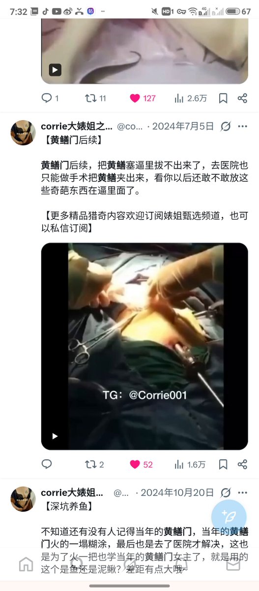 dorm404's tweet photo. @dunyadantip Don't worry everyone, this is just a video of a woman who used an eel for masturbation and ended up having to go to the hospital to get it removed, regarding more details... https://t.co/eQMYWDqNPz