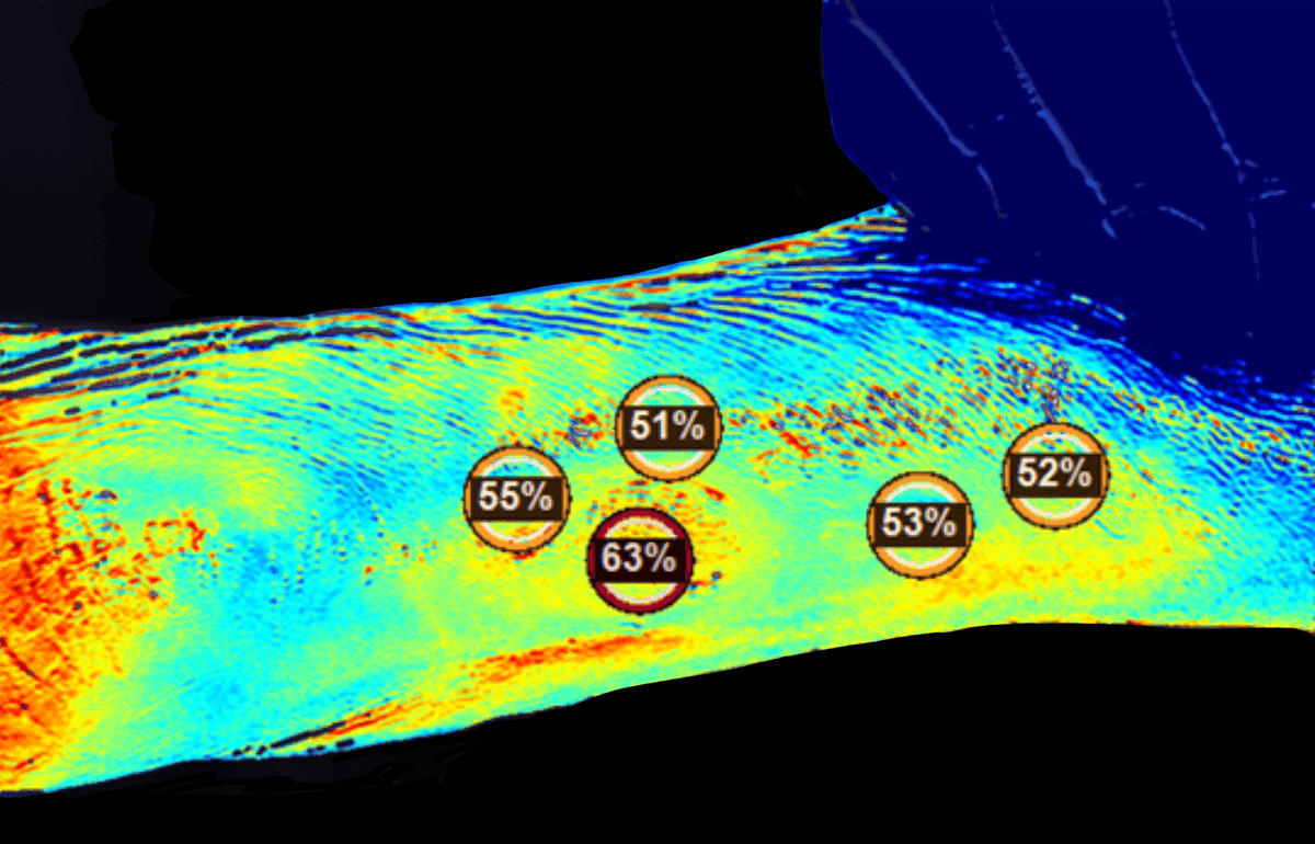 Managing nutritional skin failure is complex—especially when tissue viability is difficult to assess.

Access the full case study to see how objective oxygenation data supported clinical decision‑making in these complex wounds.

Download hubs.la/Q040nvDv0