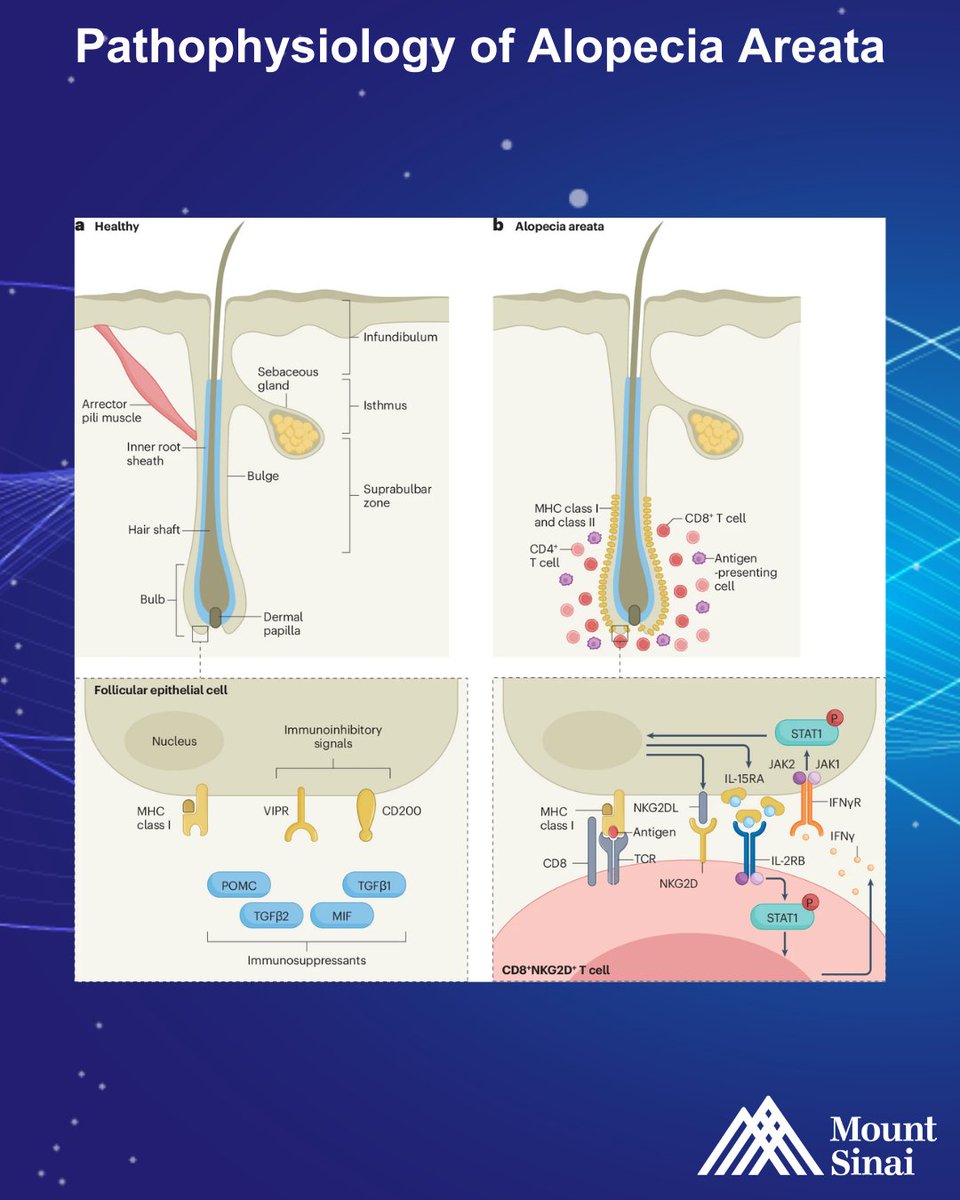 Mount Sinai Dermatology tweet media