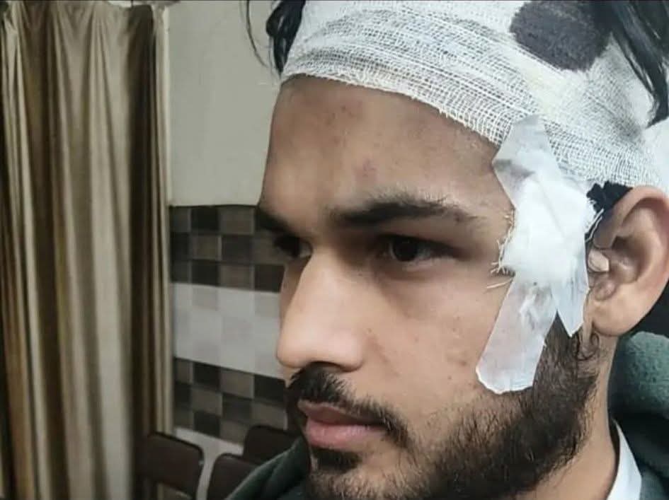 सहारनपुर | थाना बड़गांव
गांव झबीरन के पास 3 युवकों को बेरहमी से पीटा गया।
पीड़ित अहसान (कांधला निवासी) व उसके साथी टाटा मैजिक में थे।
 थाने में तहरीर के बावजूद अब तक कोई कार्रवाई नहीं
क्या आरोपियों को संरक्षण मिला है?
👉 तत्काल गिरफ्तारी व सख़्त कार्रवाई की मांग
<a href="/saharanpurpol/">Saharanpur Police</a>