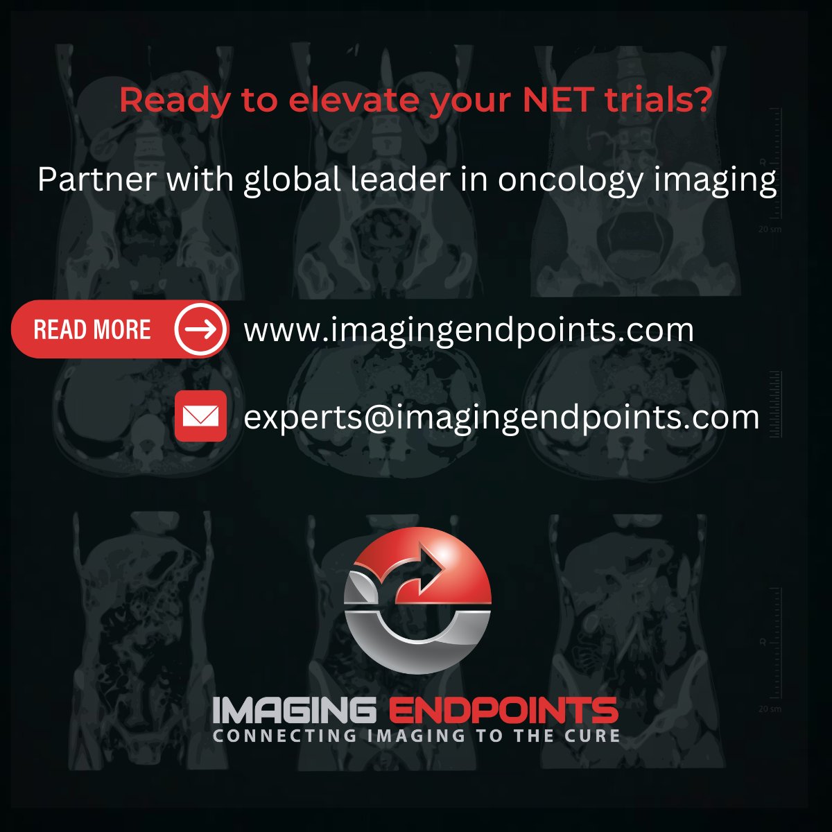 ImagingEndpoint's tweet photo. Modern NET trials rely on quantitative SSTR PET, dosimetry, and harmonized central imaging. Integrating RECIST 1.1 with SSTR PET and lesion-level dosimetry supports better patient selection, precision PRRT, and submission-ready trial data.

Read More: https://t.co/dA3c13dSUC https://t.co/ltdl1f6ehJ