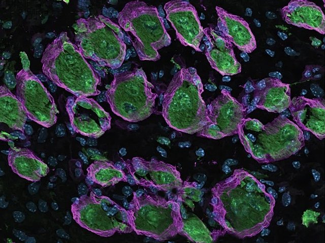 Biomedical Picture of the Day BPoD tweet media