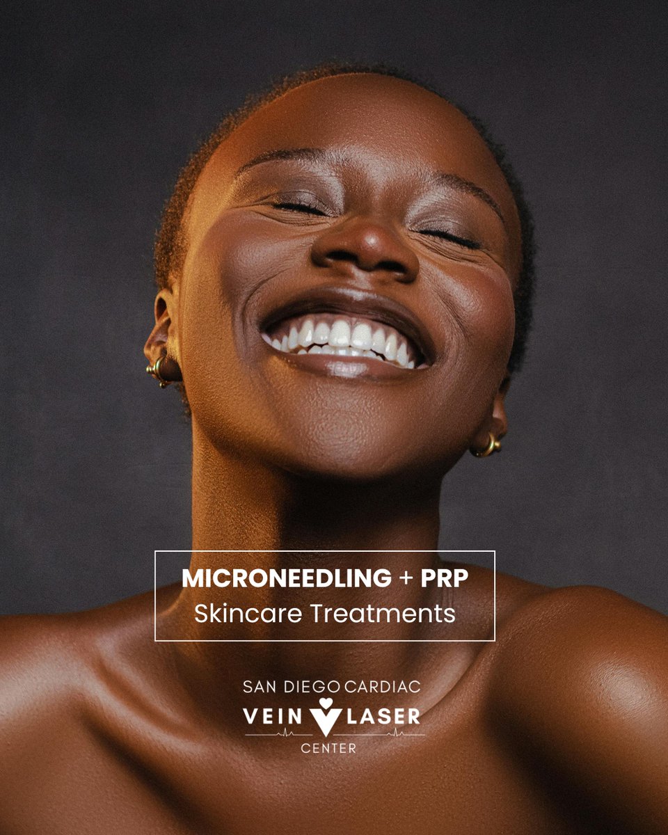 sdveintreatment's tweet image. ✨ #Microneedling with PRP: Your Skin, But Better 

Want smoother texture, brighter tone, and that healthy, natural glow? Microneedling with PRP is a powerful combo designed to help your skin renew itself from the inside out. Read the full blog.
🔗 bit.ly/microneedling-…