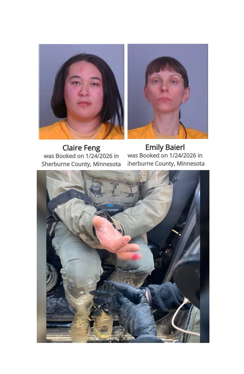 KimKatieUSA's tweet image. Meet Claire Feng and Emile Baierl the Trantifa cannibals who literally bit federal agents' fingers like rabid animals.

Claire (media calls her a “woman,” even Fox) chomped off the tip of a Border Patrol agent's right ring finger in that viral photo.

Emile bit clean into another…