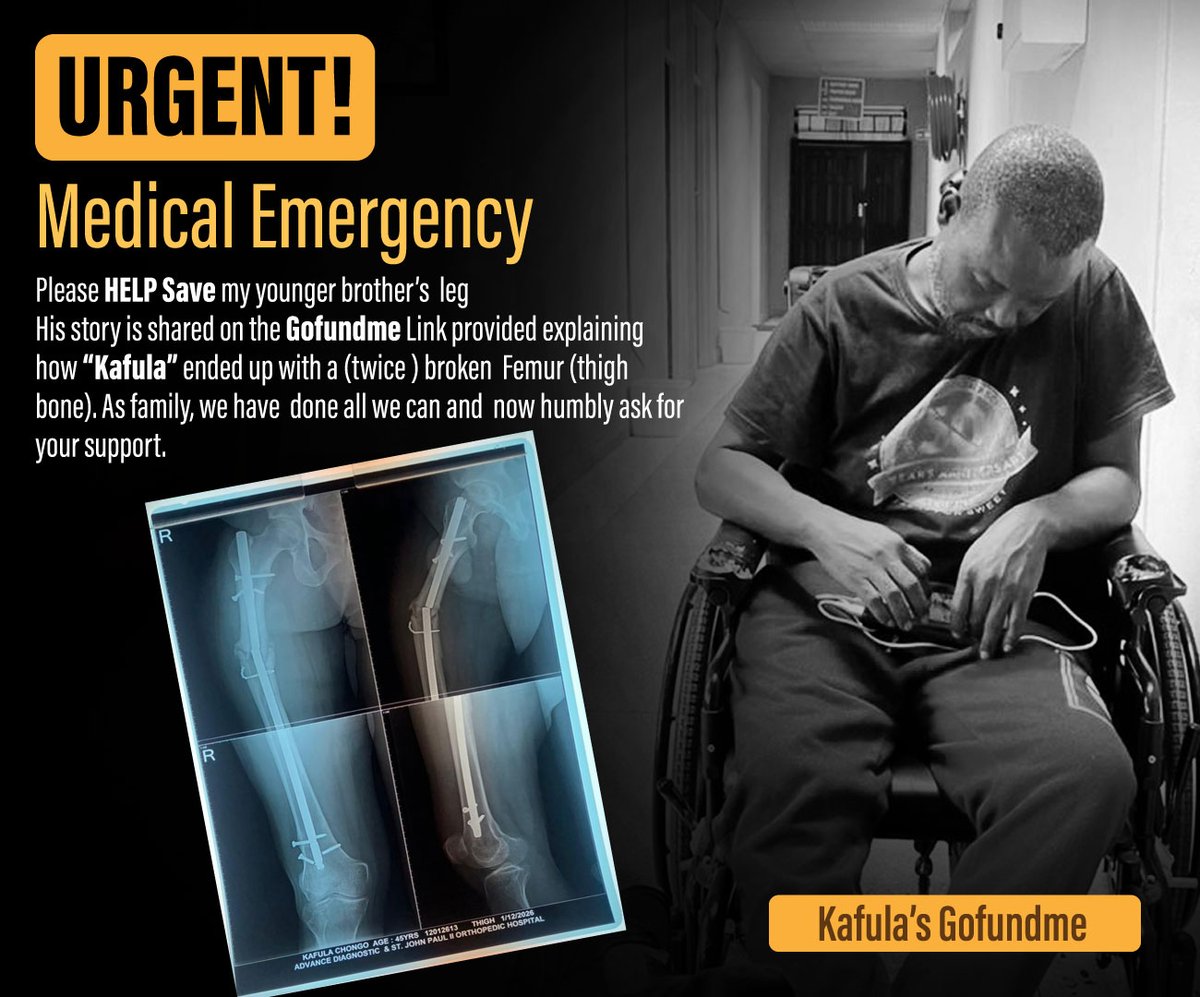 ingo970's tweet image. gofund.me/752585b89
Medical Emergency!
Please HELP save my brother's Leg!