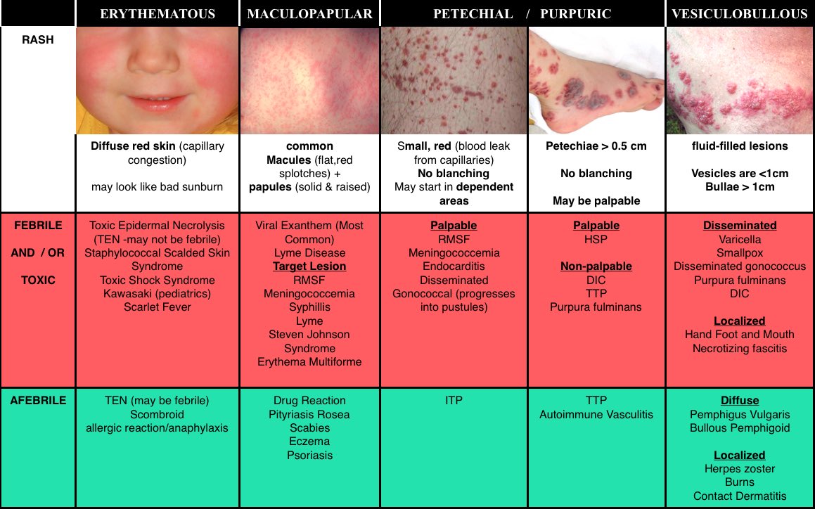TrackYourHeart's tweet photo. Petechiae &amp; Purpura https://t.co/FwxChik1hb