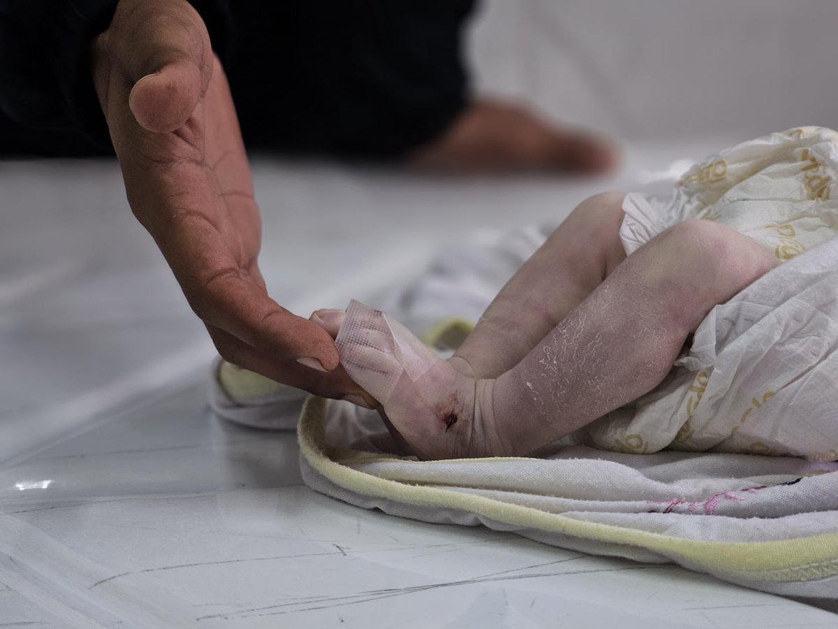 Katil İsrail'in yakıt ve insani yardım girişini engellediği Gazze'de 12 günlük bir bebek soğuktan hayatı kaybetti.

tr.trthaber.com/1/de0b4605