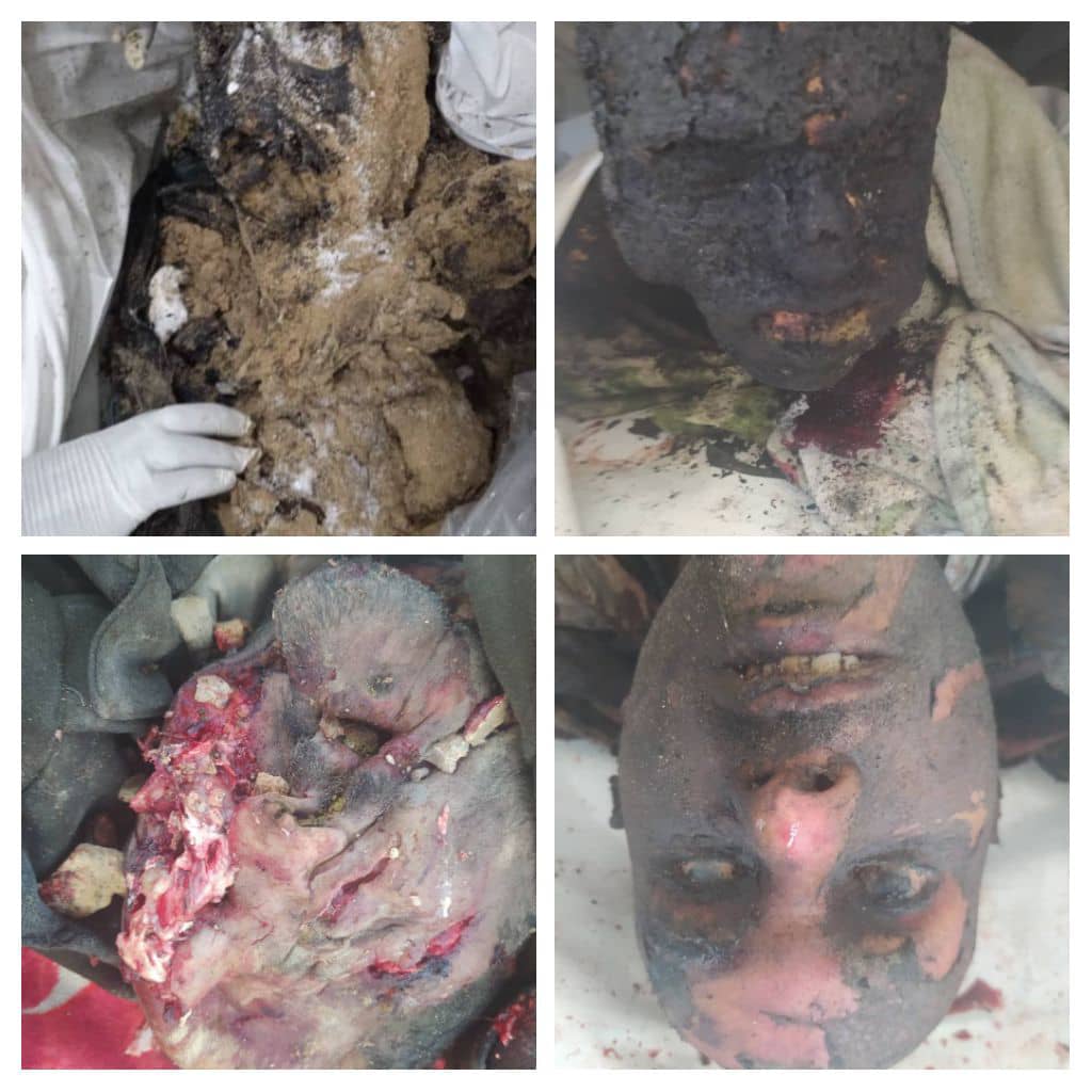 جنود القوات الجنوبيين المسلحة استخدمت السعودية أسلحة حارقة أين الأمم المتحدة إين مجلس الأمن أين العالم
شعب الجنوب لن ينسى جنوده وصحفيو الجنوب يطرقوا ابواب الامم المتحدة لادانة السعودية باارتكاب ابادة مجازر لجريمة حرب مكتملة الاركان