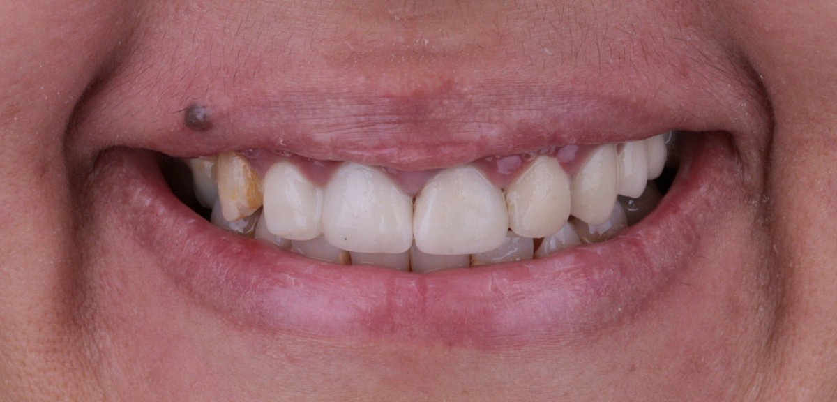 رَنْد السيف tweet media