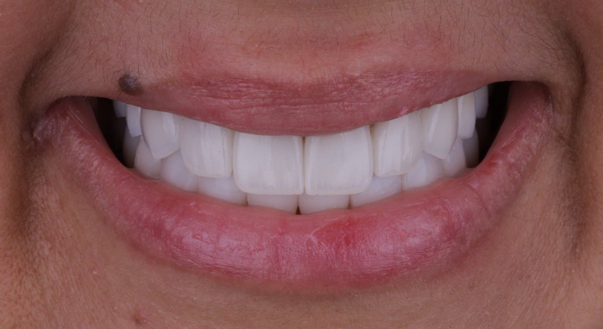 رَنْد السيف tweet media