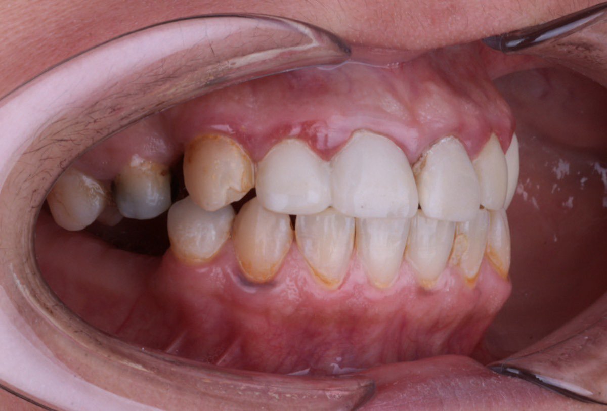 رَنْد السيف tweet media