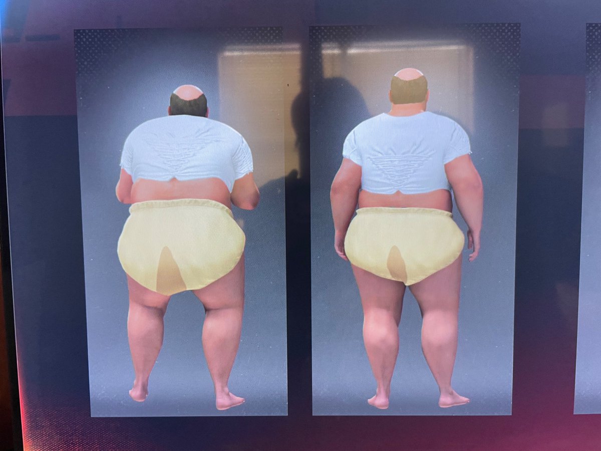OfficialCCW1's tweet photo. It’s Day 3 and @RoperShad is still nothing more than a fat pathetic scum-sucking pedo-loving diaper baby.

Spread this on his profile just to piss him off even more. 

#ShadRoper #ShadRoperIsADiaperBaby https://t.co/HatLgJjOd2