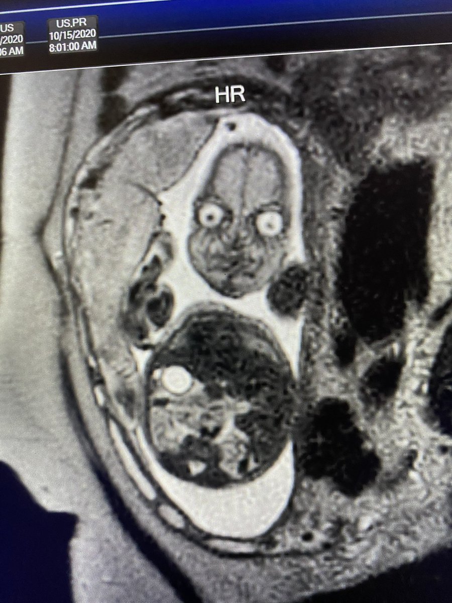 kiersten 🍄 tweet media