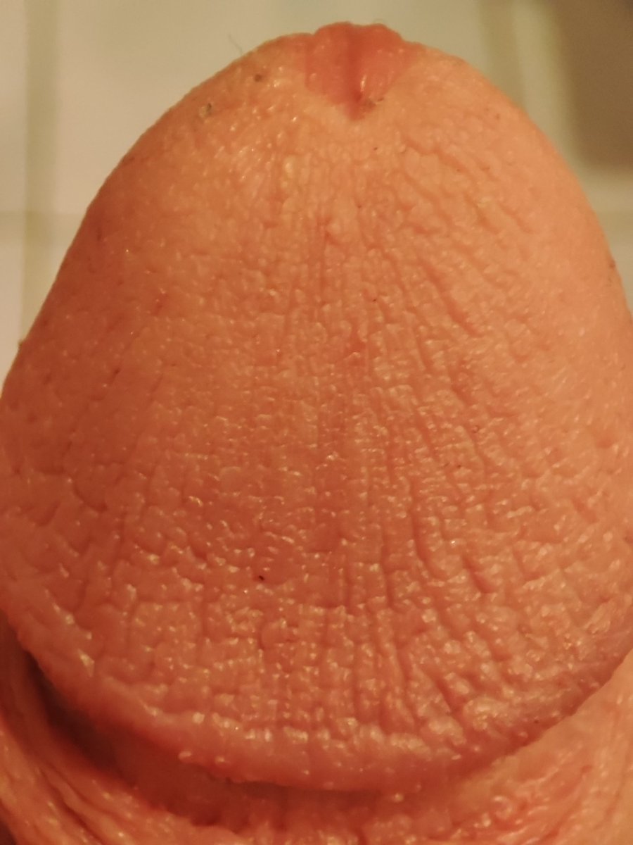 TirpitzVonAzur's tweet photo. Up close on my half erect tip
#penis #teencock #hornyteen #teenpenis #foreskin #uncutcock #virgin https://t.co/VO4p8Pf3wq
