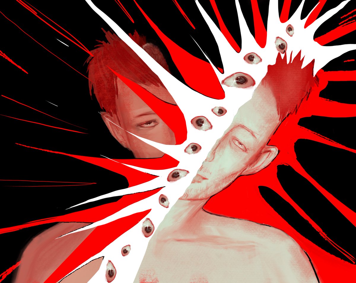 hes got a slight headache.. #radiohead