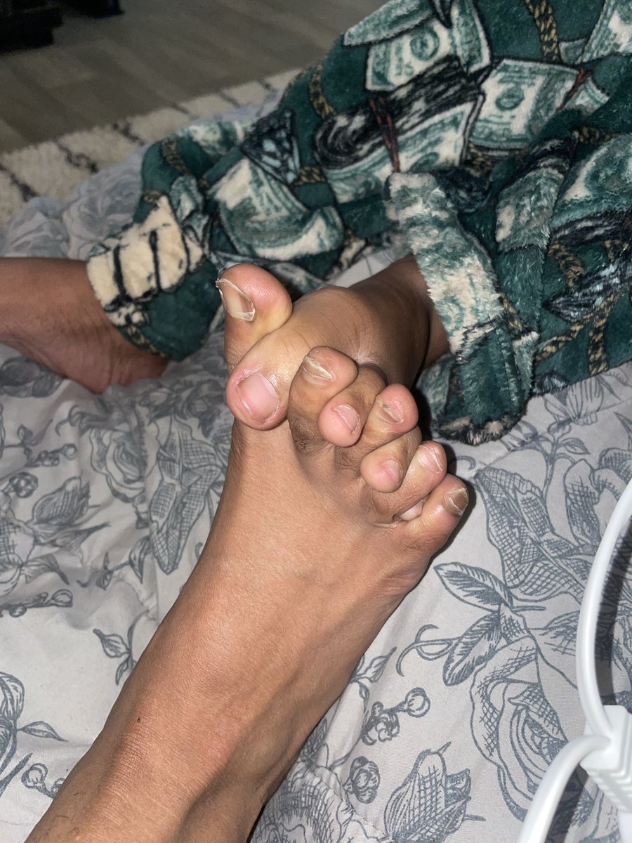 sacredsoleunion's tweet photo. Welcome to the temptation ๐
toe curl checkโฆ passed ๐
details matter ๐ฆถ๐ฝโจ left or right ๐
#ToeTemptation #FeetOfInstagram #ToeCurl #SoleEnergy #FeetLovers #SoftSoles #NaturalFeet #Unfiltered #FootContent #FeetAesthetic #QueerOwned #LGBTQBusiness #leftorright https://t.co/5lGhapm9dD