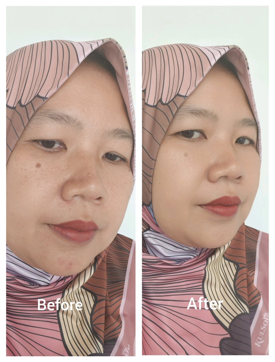 unie_46's tweet photo. Acne Pimple Master Patch ini terdiri dari 24 sticker jerawat dengan 3 ukuran. Cara penggunaannya juga gampang banget gaes. Tempelkan aja pada wajah yang berjerawat dan dalam kondisi bersih dan kering. Yuk, checkout disini https://t.co/TN4wuY18mz https://t.co/5DWj1Z41OJ