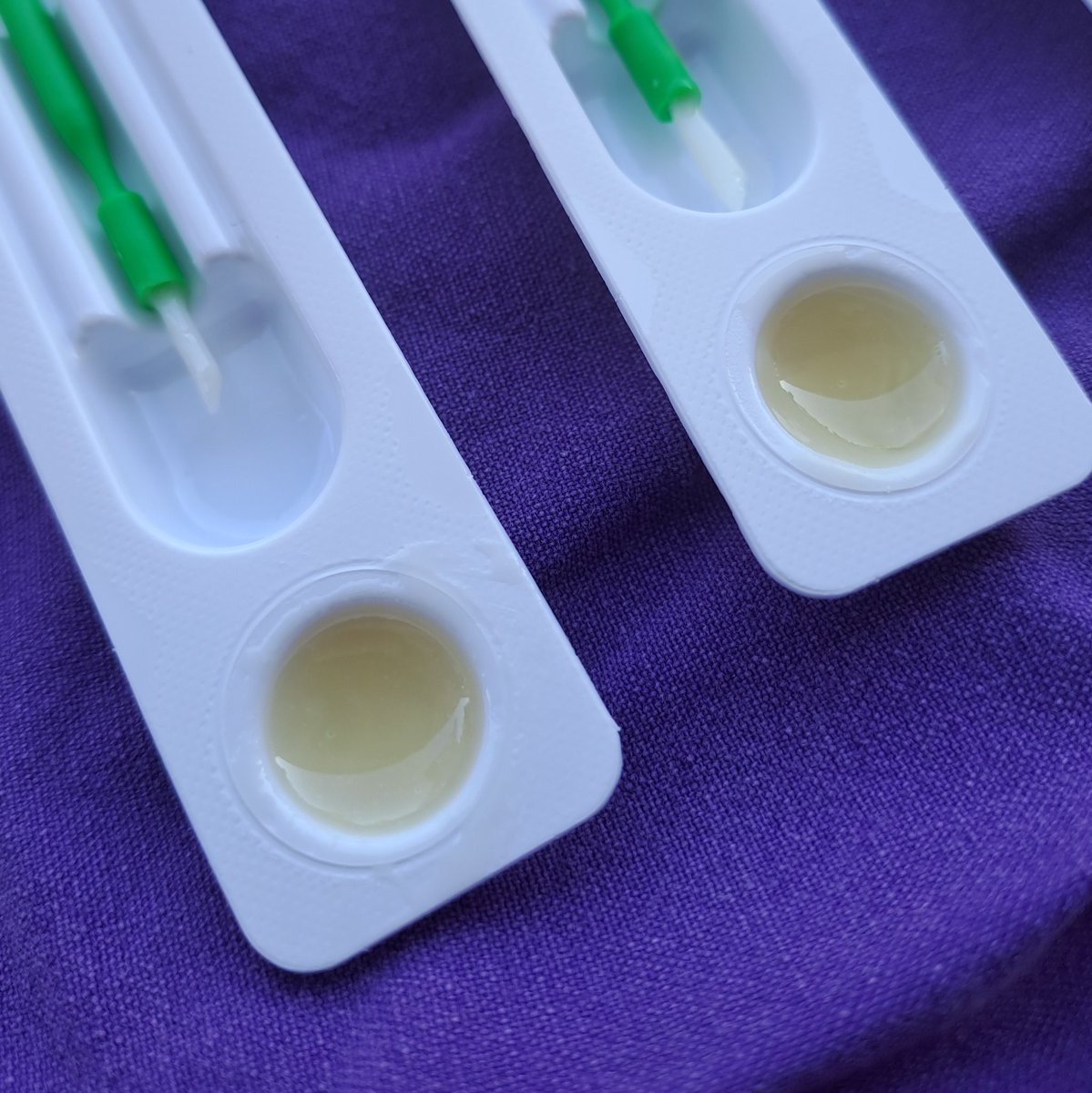 วันนี้เคลือบฟลูออไรด์เด็กน้อย
เจอเด็กพูด 67 ใส่ //เหม่อ