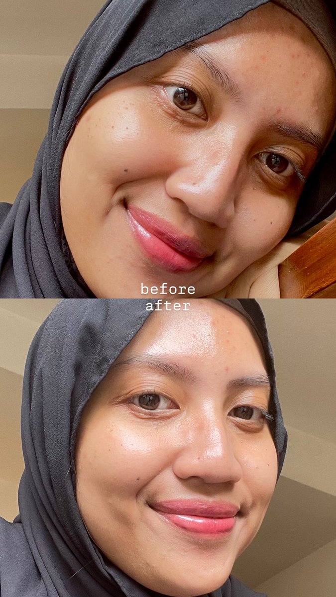 biancarcs_'s tweet image. my HOLY GRAIL Korean skincare… COSRX Low pH Good Morning Gel Cleanser!

aku suka bgt sama feels after pemakaiannya karena ga bikin wajah ketarik dan tetep lembab.