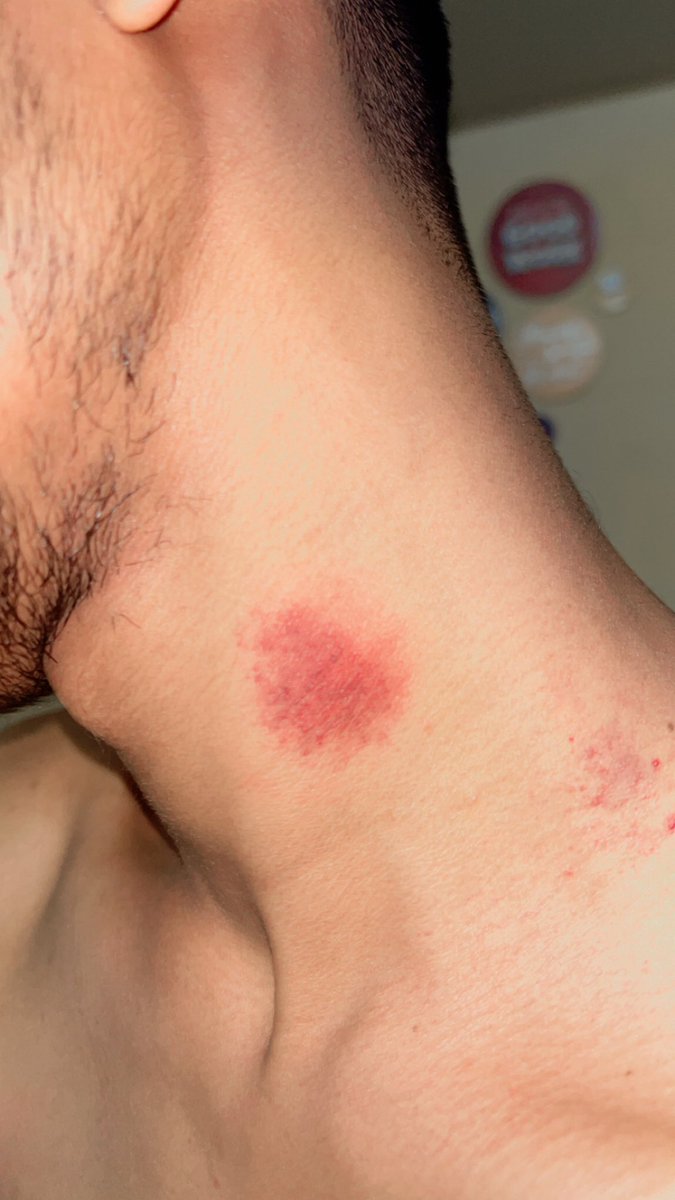 Slut_hyderbdhere🇮🇳 tweet media