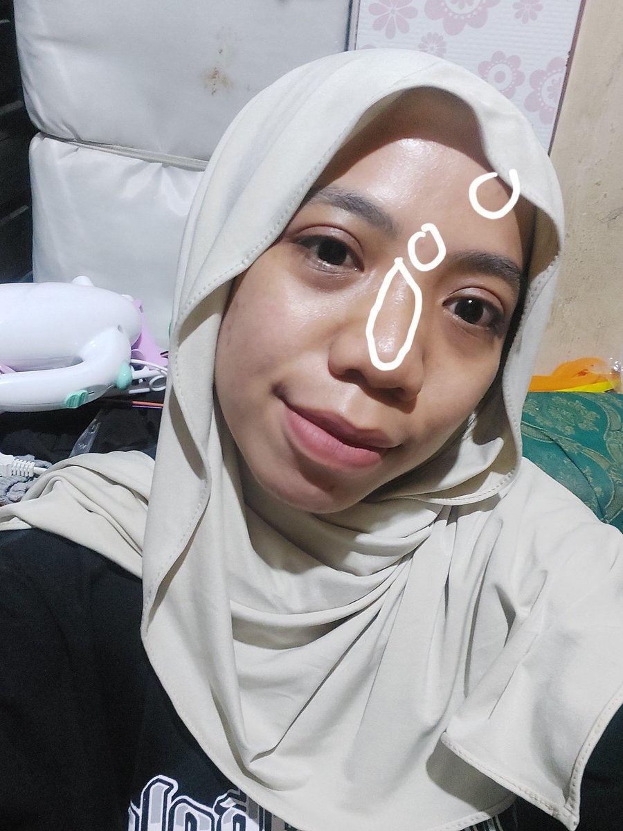 alisthaaa_'s tweet image. Sipenyelamat dari kulit gradakan dan komedo bisa hempasss dengan exfoliasi pake COSRX AHA BHA Clarifying Treatment Toner ini, demi apapun ngaruh bgt di aku