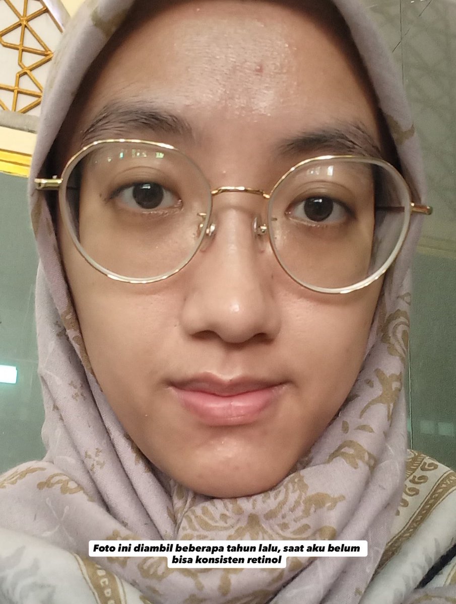 Juwi 🌻🌻 tweet media