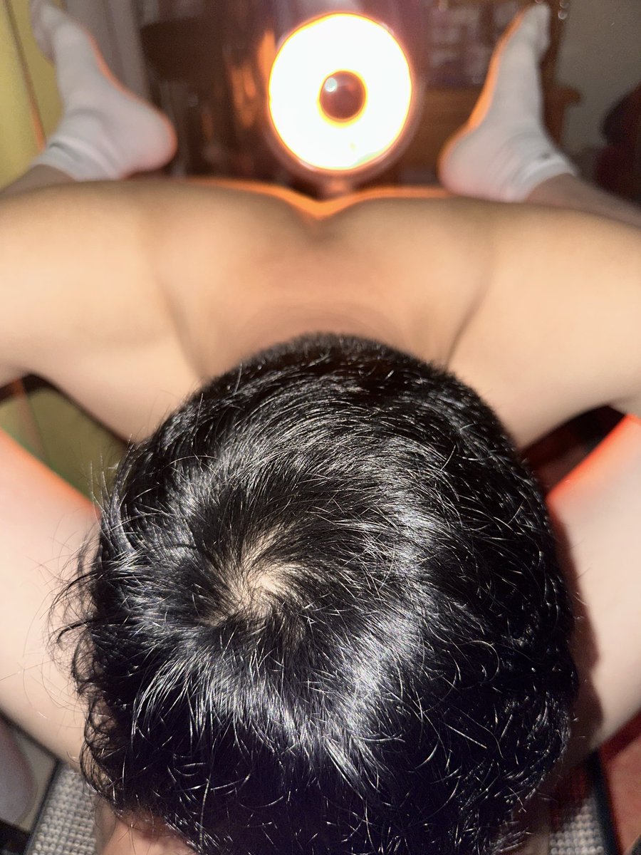 阿司不匹林 tweet media