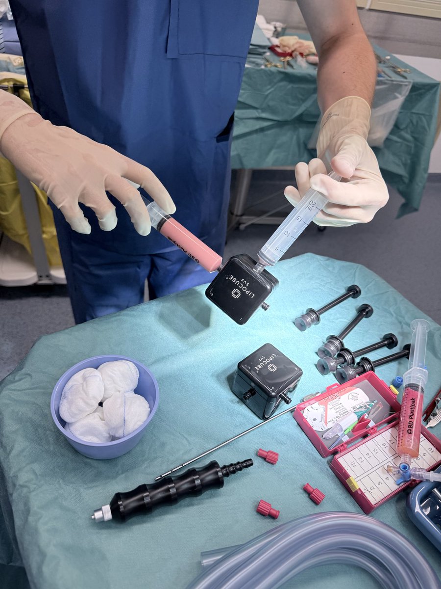 crscarpa's tweet photo. End of Sept 2025: first successful treatment of a complex, recurrent anal fistula in Crohn’s disease combining sphincter-preserving fistulectomy with autologous SVF injection (Lipocube).
At 4-month follow-up: complete healing.
👉 Innovation serving patients. https://t.co/2ngARwDJKa