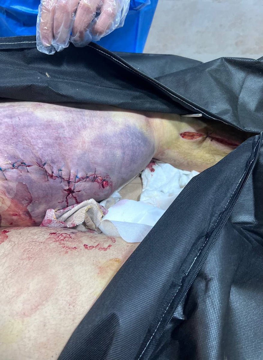 ⚠️ Content warning

Majid Farnia was shot in the leg and taken to the hospital while still conscious. His family received his body - with a bullet in his head.

Majid was executed inside the hospital.