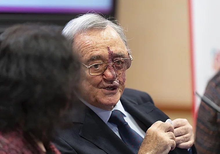 Eyaaaad's tweet image. فريق من العلماء في إسبانيا يُعلنون عن اكتشاف علاج لواحد من أشرس السرطانات على الإطلاق (سرطان البنكرياس) والذي تصل نسبة الوفيات منه إلى 97%.

العالِم الإسباني Mariano Barbacid وفريقه من "المركز الوطني الإسباني لأبحاث السرطان" أصبحوا حديث الساعة في الأوساط العلمية حاليًا بعد نجاحهم…