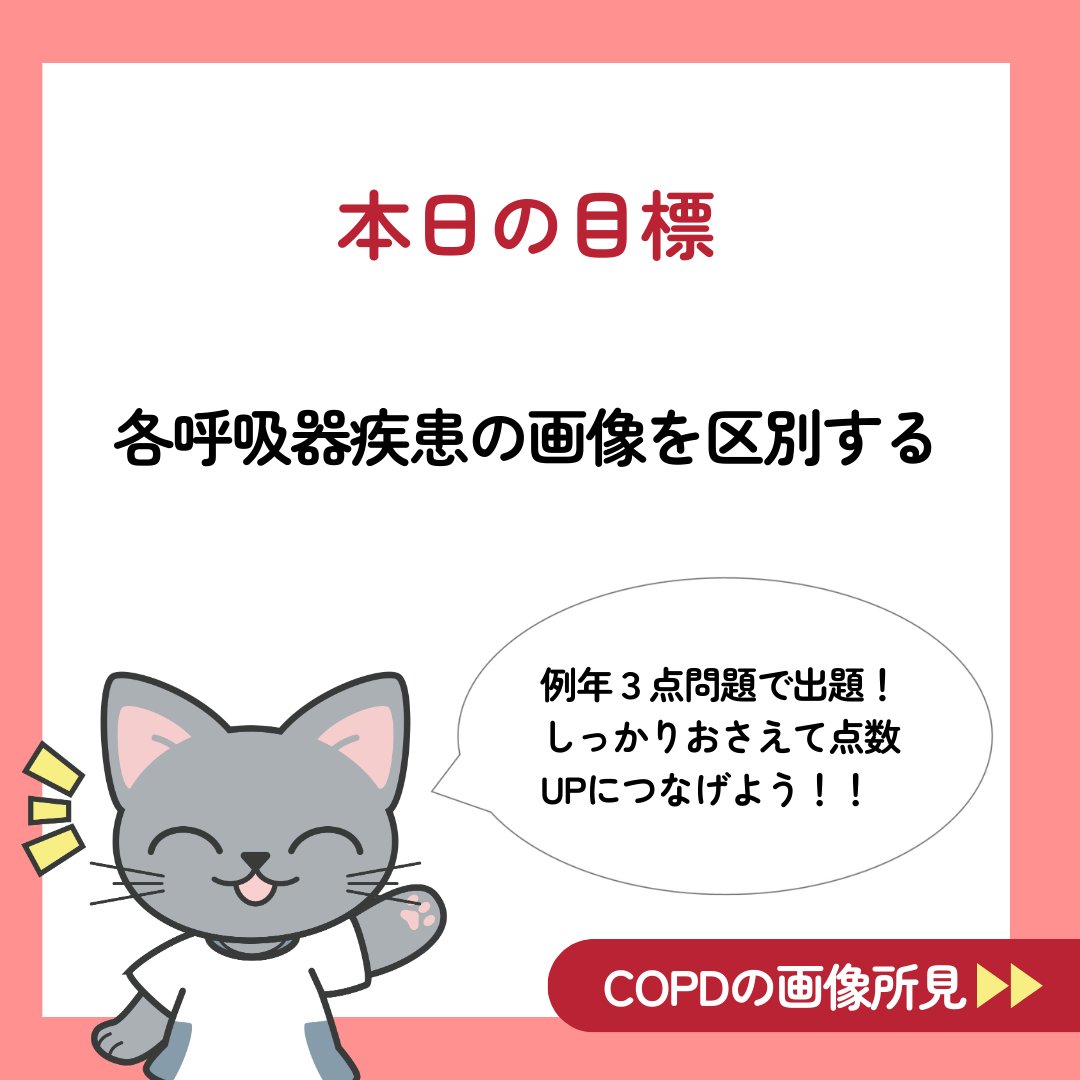 medic_PTOT's tweet photo. 「呼吸器のX線、どれも同じに見える…」😵‍💫
ポイントを押さえて区別できるようにしましょう！

まずは「画像」をスワイプしてクイズを解き、下の解説を読んでください！👇
＿＿＿＿＿＿＿＿＿＿＿＿＿＿＿＿＿

● まずは「対照的な2つ」を整理 ここが一番の狙われ目です。「肺の大きさ」に注目してください。

① COPD（肺気腫など）空気が吐き出せず、肺がパンパンに膨らみます。

肺野：黒っぽい（透過性亢進）

横隔膜：下がる（平低化）

心臓：縦長になる（滴状心）

② 間質性肺炎肺が線維化して硬くなり、縮こまります。

肺野：白い網目状（網状陰影・すりガラス陰影）

横隔膜：上がる（挙上）

＿＿＿＿＿＿＿＿＿＿＿＿＿＿＿＿＿

● その他の重要疾患のキーワード

肺水腫：水が溜まる。「心拡大」「胸水」

誤嚥性肺炎：重力で落ちやすい「右の下葉」に影が出る。

肺癌：白い塊（腫瘤影）が見える。

＿＿＿＿＿＿＿＿＿＿＿＿＿＿＿＿＿

画像問題は「間違い探し」の感覚に近いです。
「黒くて大きいか？（COPD）」「白くて縮んでいるか？（間質性）」 まずはここから見分けていきましょう😊

#PTOT国試 #理学療法士 #作業療法士 #国試対策 #呼吸器 #画像所見