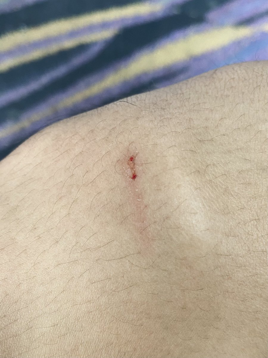 Brixtthon's tweet image. td ga sengaja kena alat gym, auh bubbb 🥹