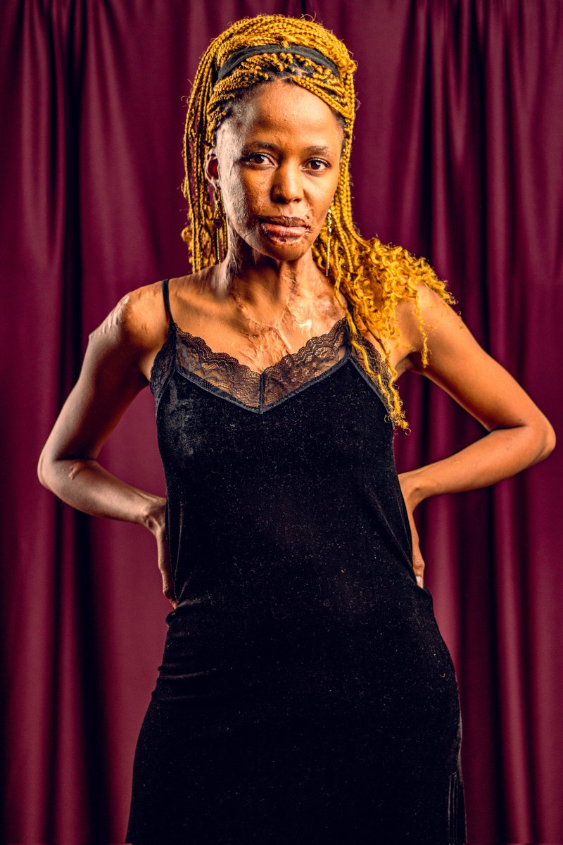 eva_rakitla's tweet photo. Inclusion is not a campaign 
It is a responsibility.
Fashion,media,and institutions must stop framing survivor visibility as exceptional and start treating it as normal.
📸@em_studios01

#represenationMatters #VisibilityMatters #designers #beauty #fashion #model #CreativeArts https://t.co/HUhEIkk69d