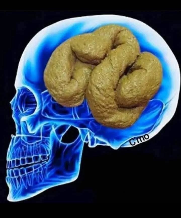 Kdo to byl na rentgenu?