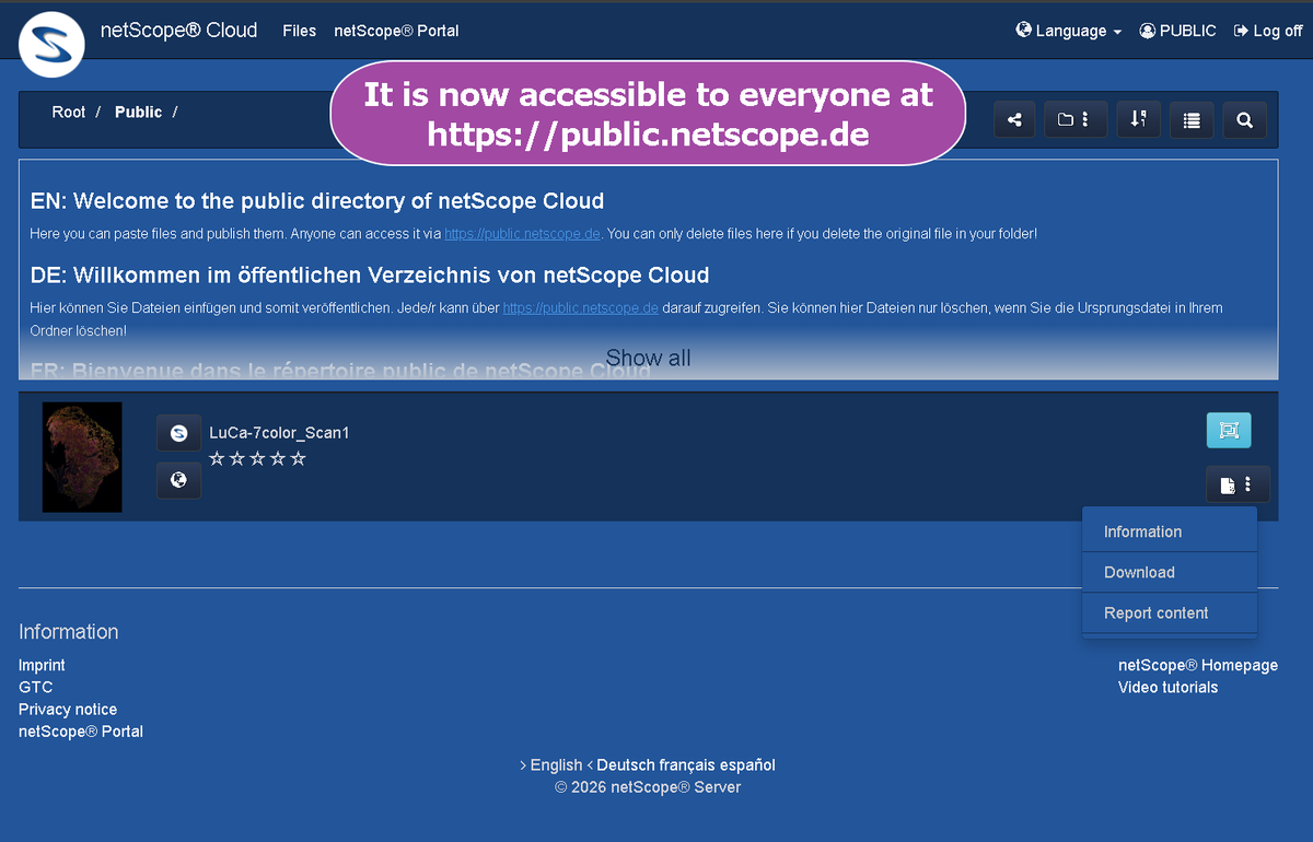 How can you use free netScope Cloud to share microscopy files with other pathologists or vets?
netScope makes it easy to share complex #WSI files, such as #MRXS or fluorescence, with macOS users.
netscope.de/en/cloud
(For personal sharing use a Cloud Premium Subscription.)