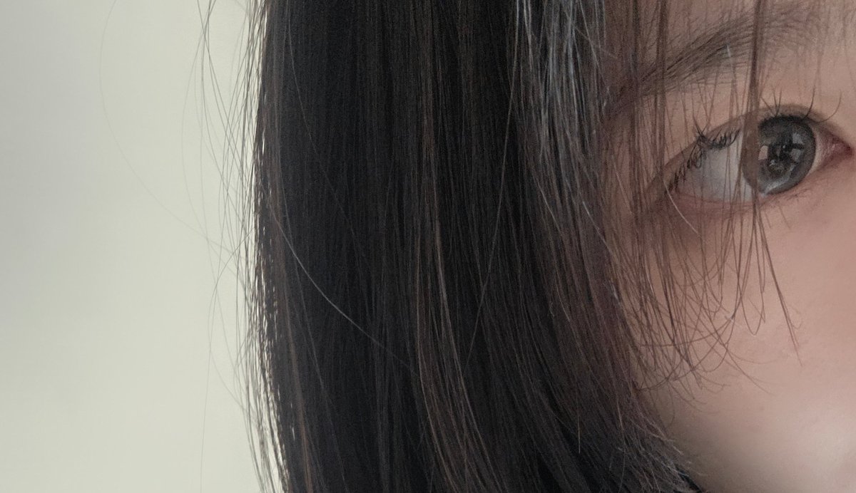 다들 렌즈 오랜 기간 끼지 마세요.

저는 렌즈를 15년째 거의 매일 끼고 다녔어요😂 (ㄹㅇ 후회중...)

최근에 시야가 계속 뿌옇게 보이고
눈 통증이 너무 심해서 오늘 안과 갔더니
각막에 신생혈관이 생겼대요…

그리고 망막 변성도 시작됐다구
지금부터 제대로 관리 안 하면 실명 위험까지 있다고…