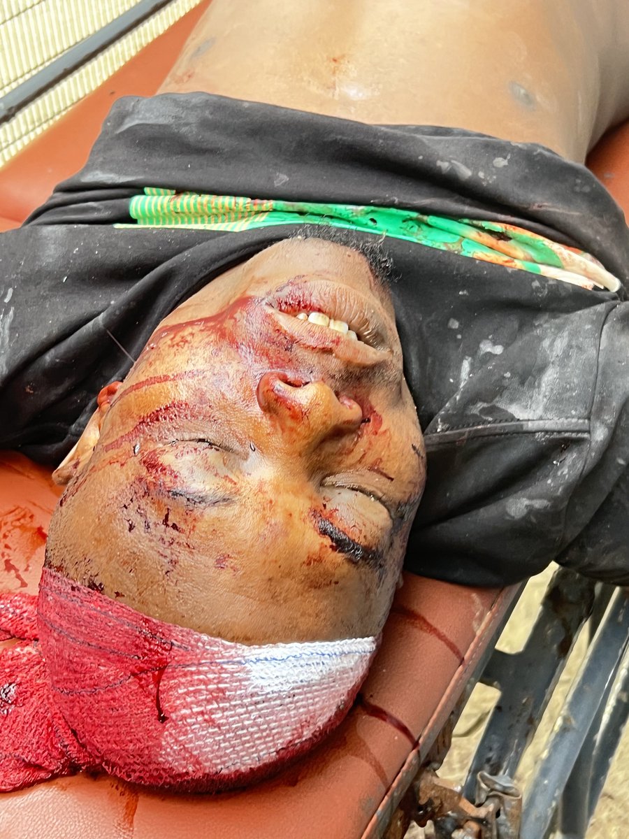 TundeSmilez's tweet photo. CALL FOR JUSTICE!!!! 

How Olamide was allegedly murdered by a trigger happy naval officer on 25/01/2026 at Ikorodu Lagos. Based on eyewitness account. 

Warning: graphic image 

Cc: @NigerianNavy @PoliceNG @DavidHundeyin @fisayosoyombo @Mazi_OJD @BBCAfrica @lollypeezle https://t.co/k1YqQxR6d5