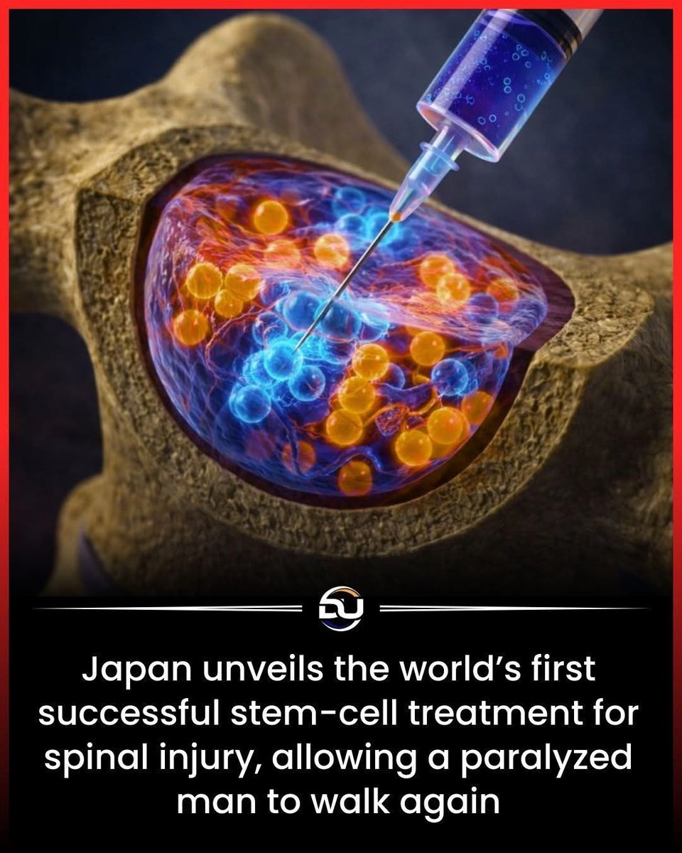 argosaki's tweet photo. Japan’s Stem Cell Breakthrough Helps Paralysed Patient Walk Again

For decades, spinal cord injuries were considered permanent life sentences. Once the connection between brain and body was severed, science believed there was no way back. In a historic medical breakthrough, Japanese researchers have now proven that belief may be outdated. For the first time in the world, a paralysed man has regained the ability to walk after receiving a revolutionary stem cell treatment designed to repair damaged spinal nerves.

The patient had lost movement after a severe spinal injury, relying entirely on assistance for daily life. Traditional treatments focused only on preventing further damage, offering rehabilitation but no true repair. This new approach changes everything. Scientists used specially prepared stem cells that can develop into nerve-supporting cells, helping reconnect broken communication pathways in the spinal cord.

Instead of simply managing paralysis, the treatment encourages the body to heal itself. After receiving the therapy, the patient gradually began to regain sensation and control. Months later, he was able to stand and walk with support, a moment once thought impossible by modern medicine. Doctors describe the recovery as life changing, not just physically, but emotionally and psychologically.

This breakthrough could reshape the future of spinal injury care. Millions of people worldwide live with paralysis caused by accidents, falls, or disease. Until now, hope was limited. Compared to older methods that focused on wheelchairs and long-term care, stem cell therapy aims at restoration, independence, and dignity.

While the treatment is still in early stages and not yet widely available, its success marks a turning point. It proves that the spinal cord is not beyond repair and that the human body holds untapped healing potential.

#DiscoverTheUniverse #Discover #StemCellBreakthrough #MedicalRevolution