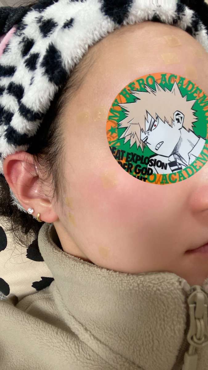 ホクロ除去痛かったけど、楽しい😂
オタク精神で肌治療ハマり散らしてる😂