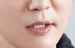 다음 중 고양이 이빨 사진을 모두 고르시오(1222점)

#안데니 #데니안