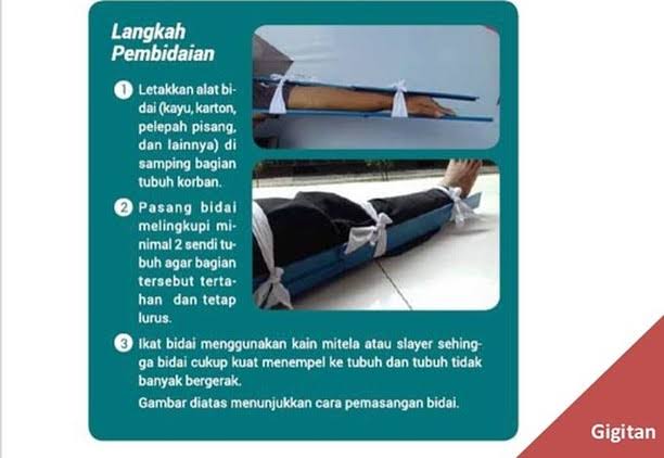 agustddiction_'s tweet photo. Setelah baca sempet diurut lalu dikeluarkan darahnya lalu diikat diatas siku. Ini tindakan yang salah ya. Bisa ular tuh nyebarnya lewat saluran getah bening. Hal yang dilakukan diatas itu cuman mempercepat penyebaran bisanya. Langkah pertama kalo tergigit ular adalah imobilisasi https://t.co/QSlX270G2L