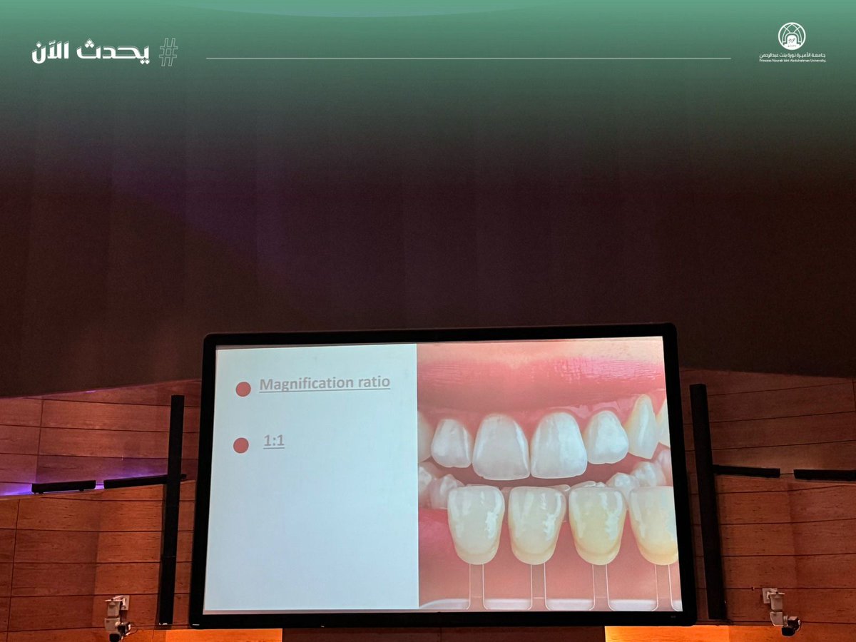 #يحدث_الآن:
تنظّم كلية طب الأسنان، بالتعاون مع عيادات طب الأسنان، ورشة عمل "Dental Photography Workshop" لطالباتها، للتعريف بأساسيات وتقنيات التصوير السريري وأهميته في التوثيق والعرض الأكاديمي، في مسرح الكلية.
#جامعة_الأميرة_نورة
#PNU