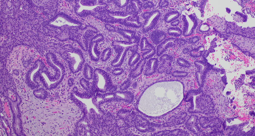 CooperPathology tweet media