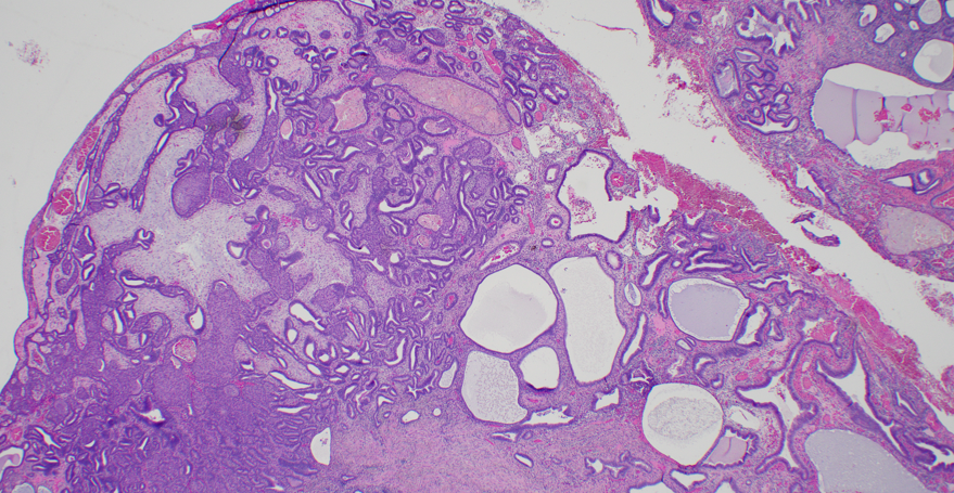 CooperPathology tweet media