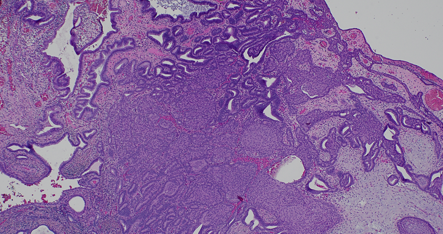 CooperPathology tweet media