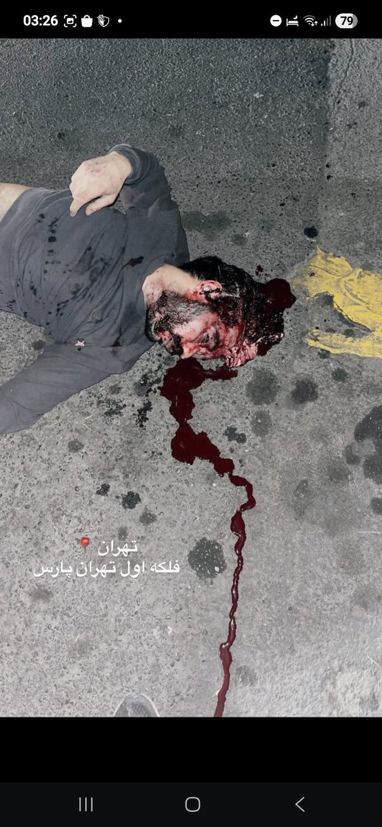 TaraShg6ro's tweet photo. ⚠️Content Warning: Graphic content.
Try to understand this pain ،you can’t.
This was a man with a family, a life, and dreams. Not a threat. Not a criminal.
He is not the only one. He is one of thousands of lives taken. One of countless people this has happened to.
His own government — the Islamic Republic, a terrorist regime — took his life.
How much more do you need to see? Silence is complicity.
#IranMassacre 
#IranRevolution2026 
#HelpIran