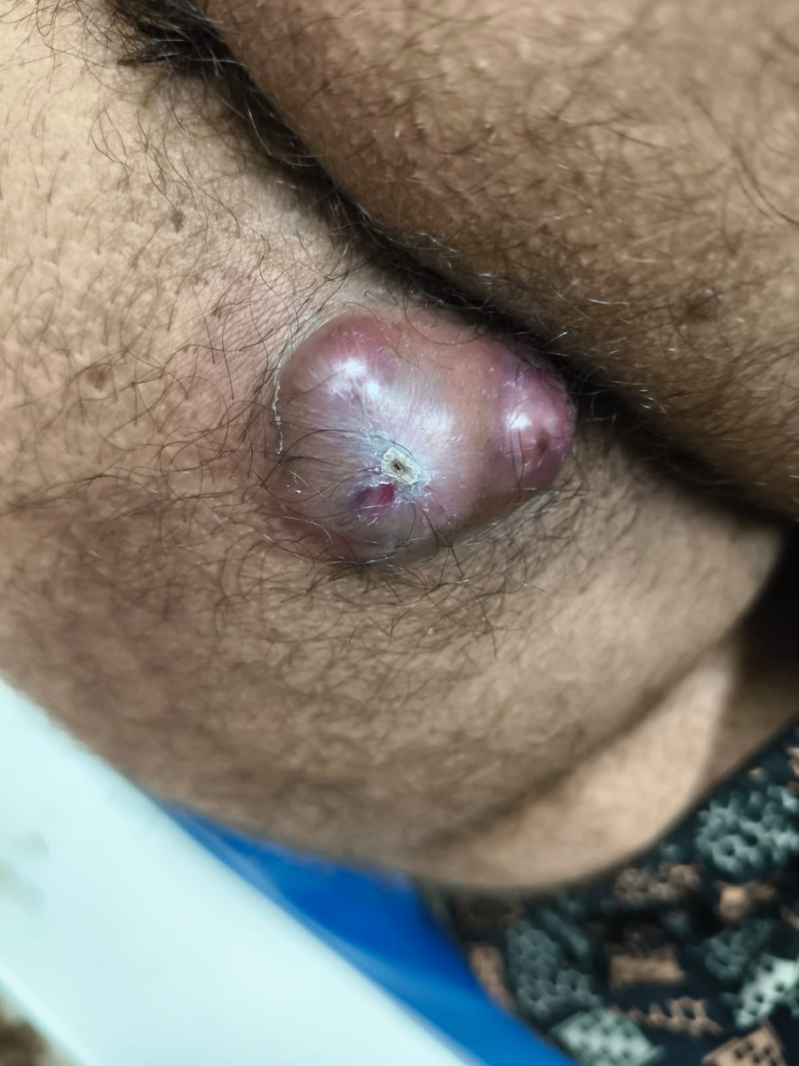 ayurveda with shravan tweet media