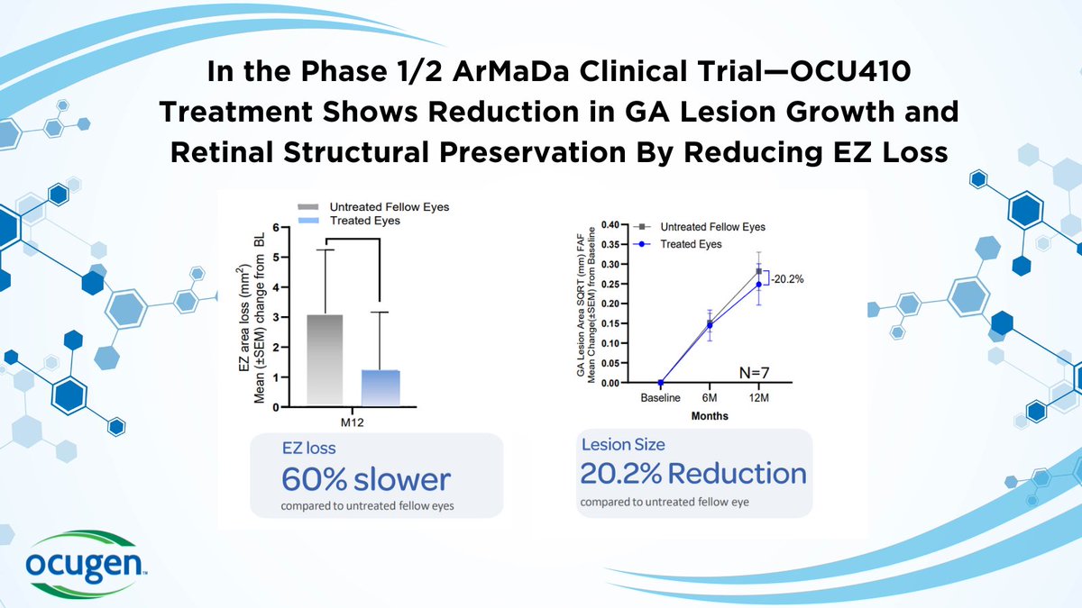 Ocugen's tweet image. 12-month Phase 1 data of #OCU410 for #geographicatrophy (GA) showed 60% slower ellipsoid zone loss and 20.2% reduction in GA lesion growth in treated eyes vs untreated eyes. Safety remains favorable with no serious adverse events reported.

Read more: bit.ly/4k2YuuK